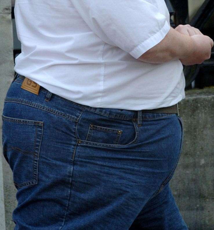 Medway has the highest number of people having bariatric surgery for obesity in the South East