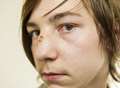 Teen suffers broken nose in brawl at football match