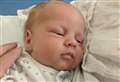 Appeal to help baby with skull condition