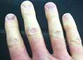 Council fined £250k over white finger syndrome