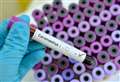 563 more people have died from coronavirus 