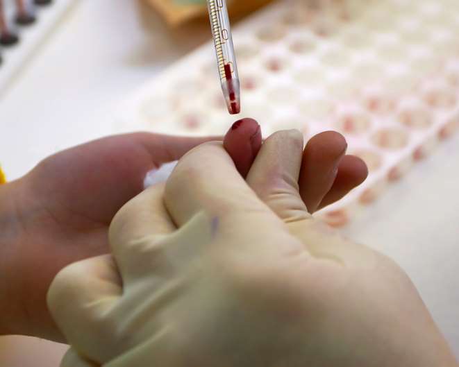 HIV tests can be carried out in just 60 seconds