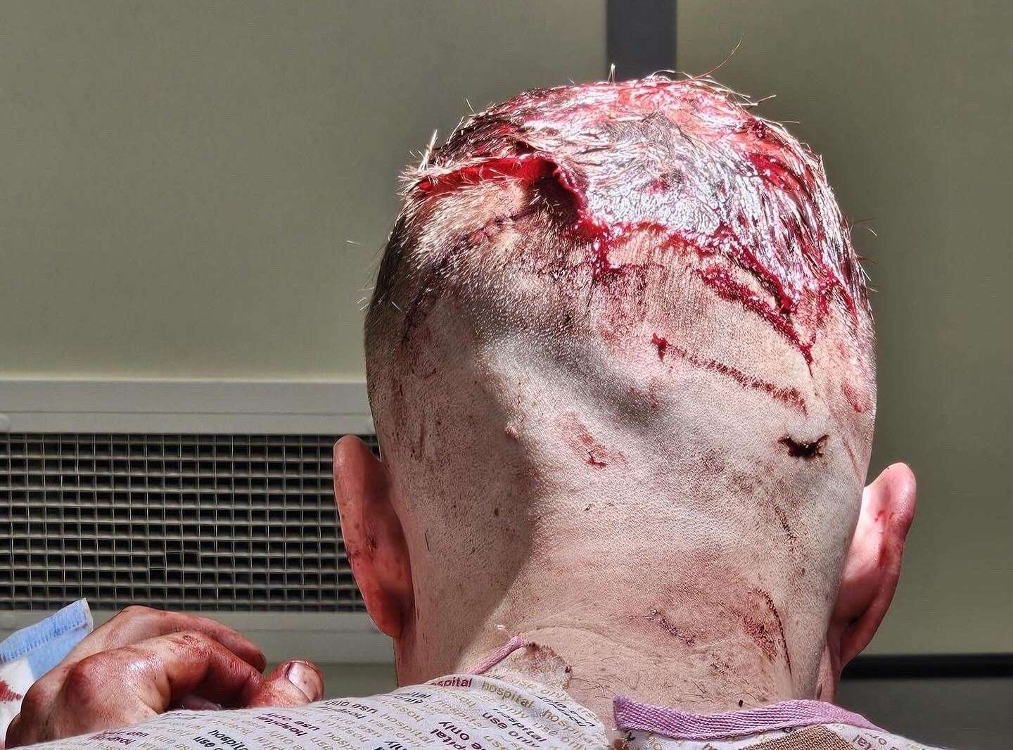 The victim was treated for wounds to the back of his head