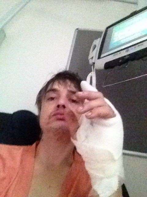 The Libertines frontman Pete Doherty shared photos of himself in a hospital bed after getting injured by a hedgehog