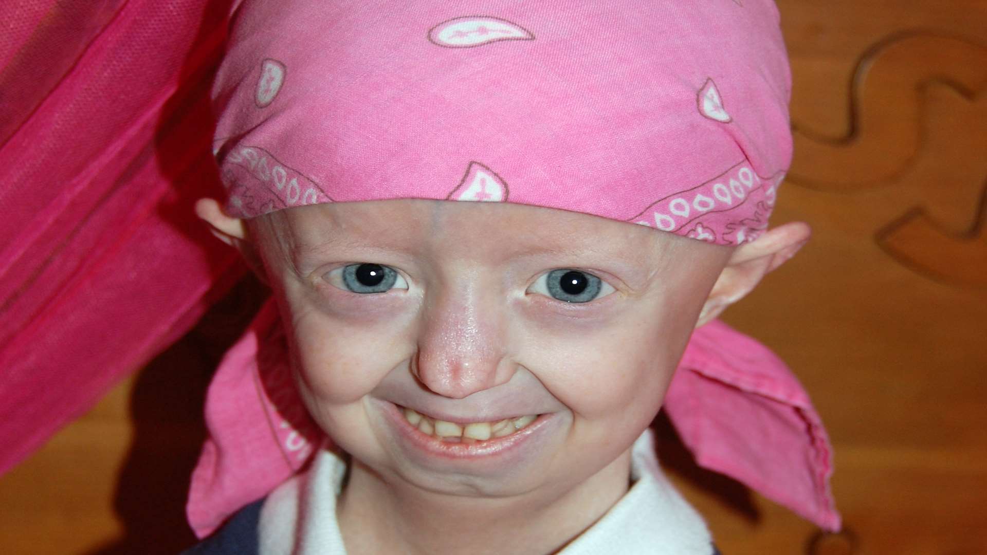 Progeria sufferer Hayley Okines has died