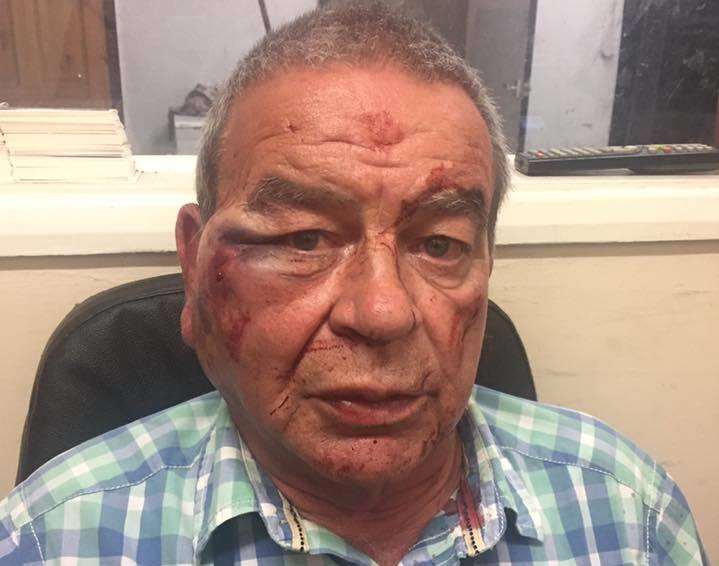 Taxi driver Rob King shortly after he was attacked in his cab while parked in Sheerness