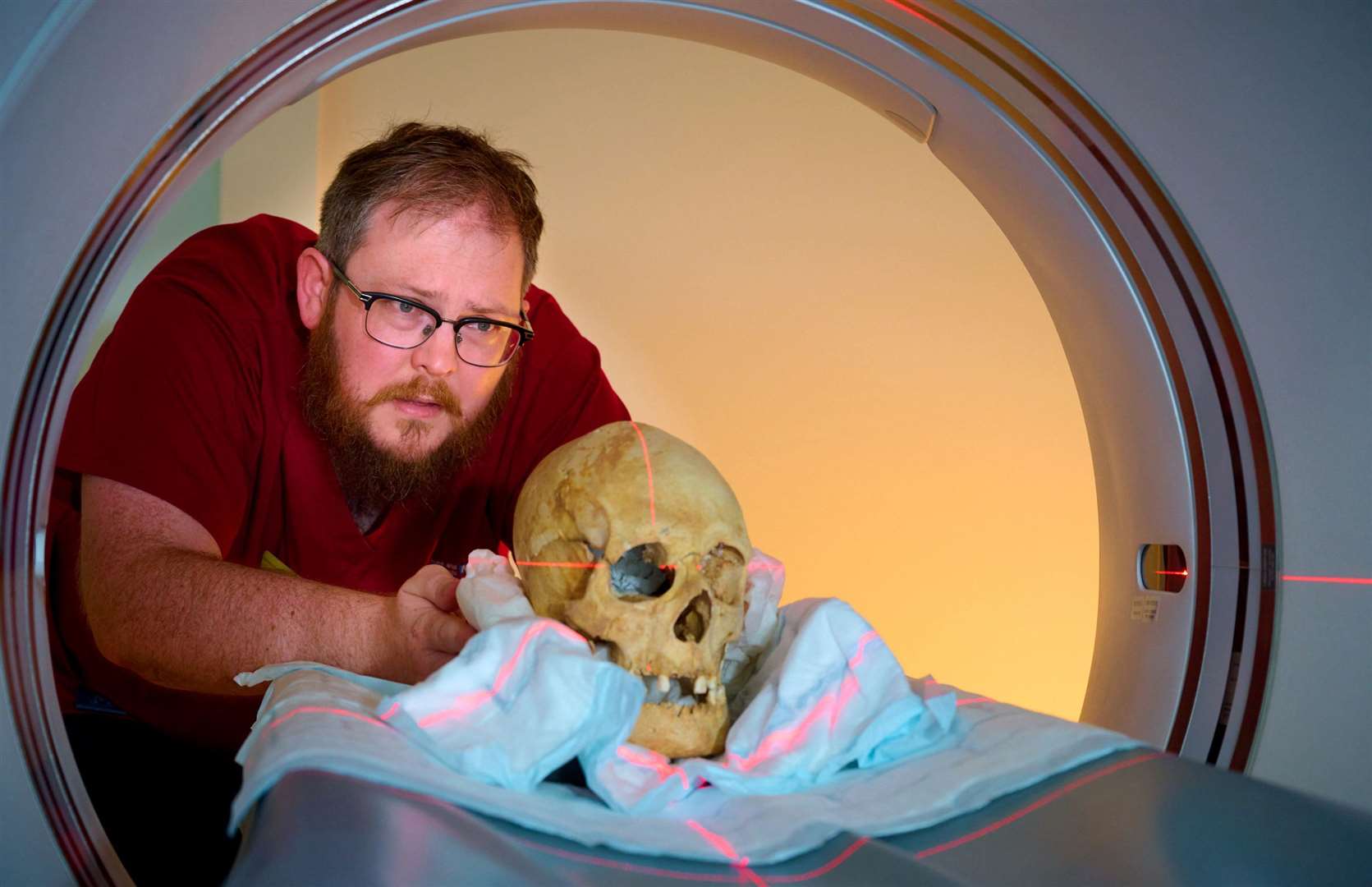 Tristan Barnden, Lead Superintendent Radiographer at Maidstone and Tunbridge Wells NHS Trust, positioning the skull for scanning
