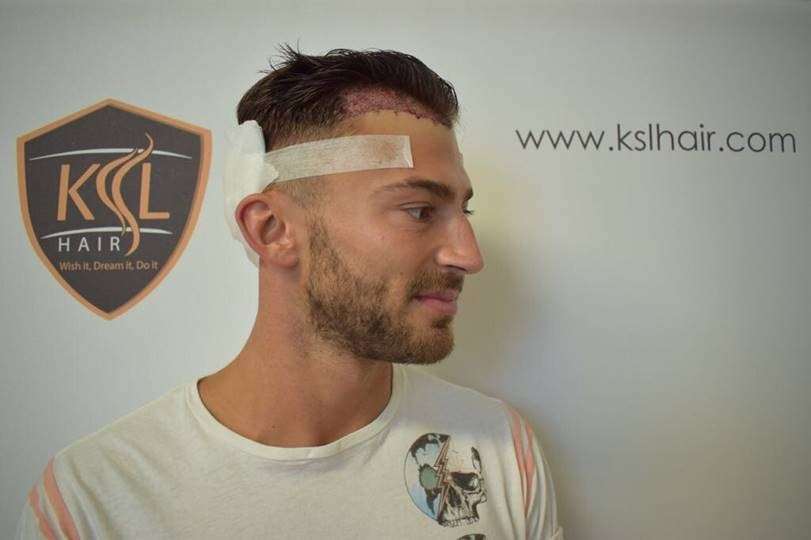 KSL Hair in Maidstone treated former X Factor contestant and I'm A Celebrity... runner up Jake Quickenden
