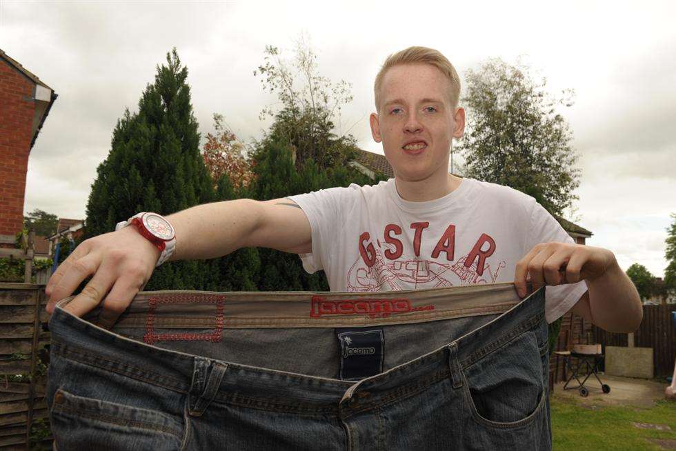 Josh Fraser, who has undergone a tummy tuck operation