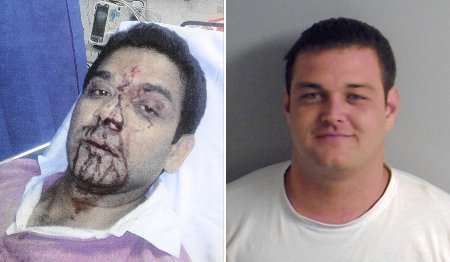 Mohammad Hossain, left, was attacked by violent yob Tony Atherton, right