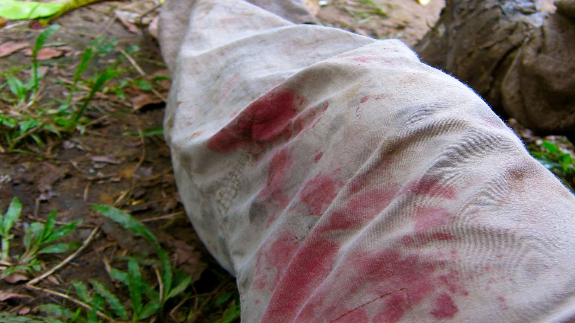 Leeches fed on Mungo's leg whilst filming in the jungle