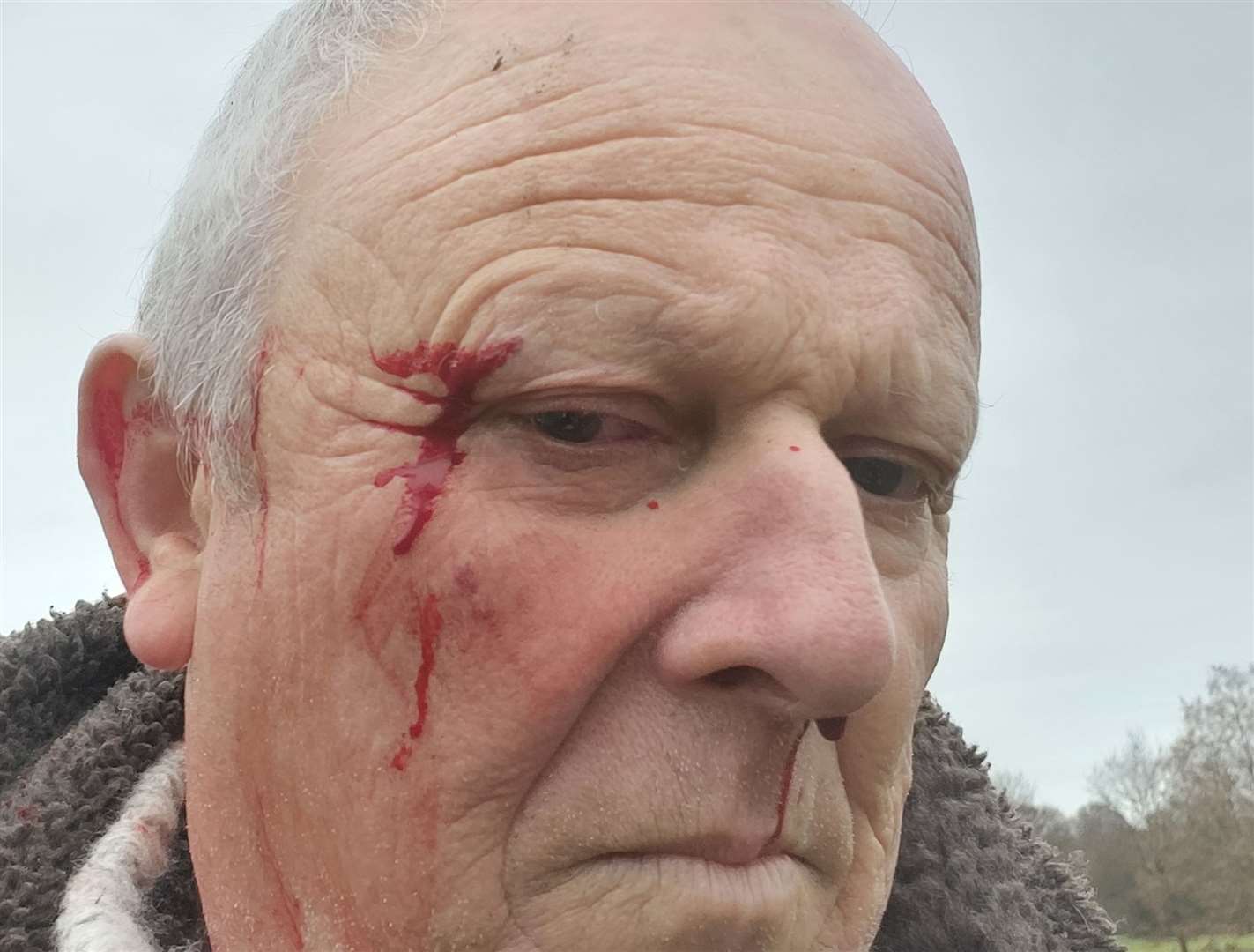 Nigel Blacklocks suffered cuts and bruising