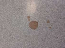 Blood stains on the floor of William Harvey Hospital