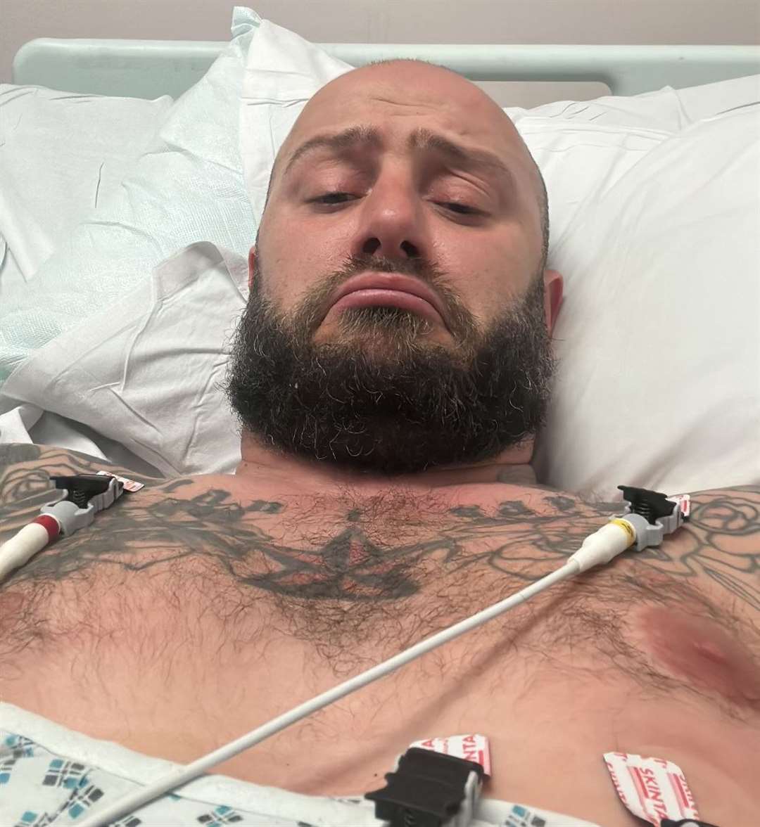 Darren Crooks, from Wingham, near Canterbury, in hospital after hitting a pothole on his motorbike and crashing. Picture: Darren Crooks