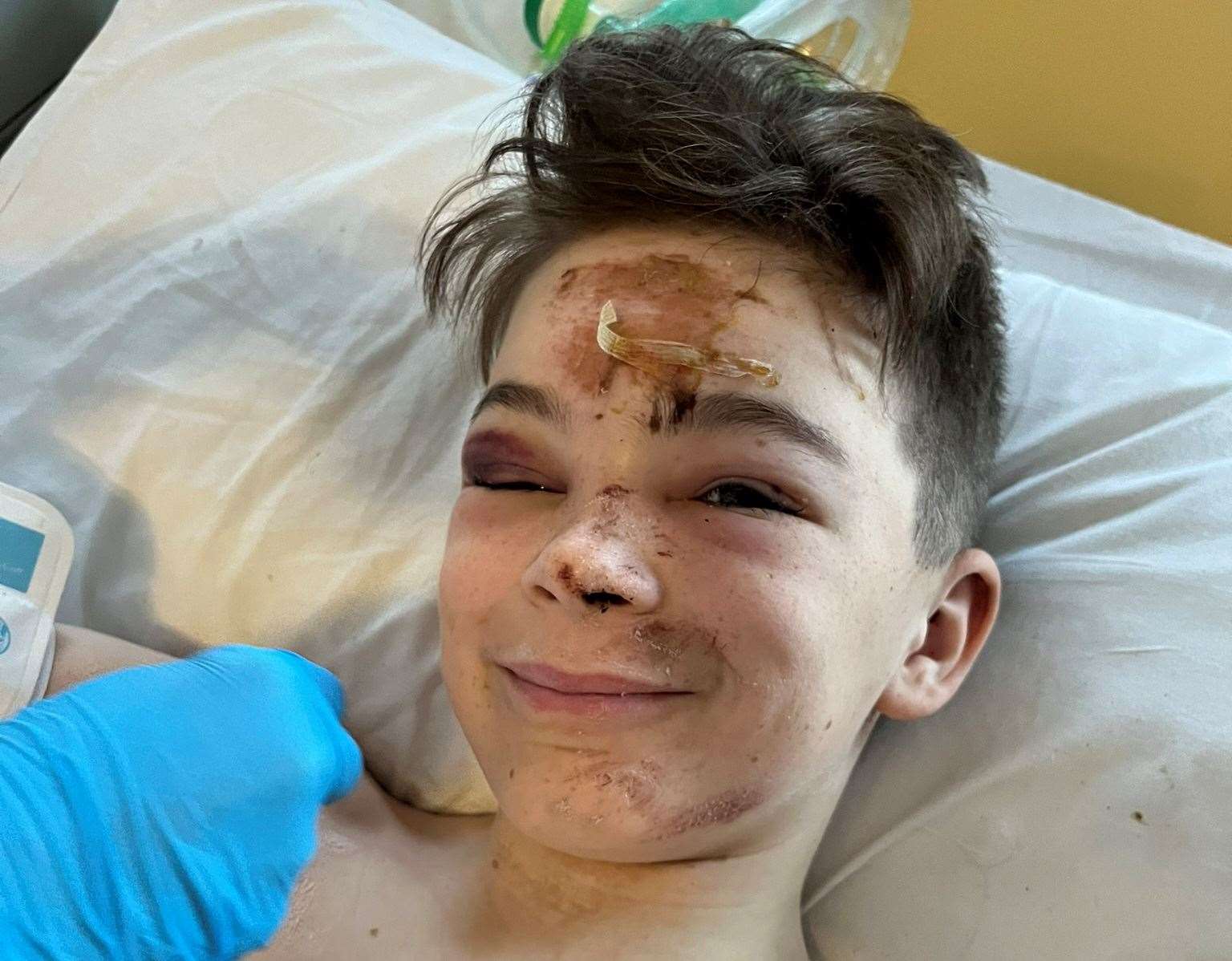 He suffered fractures to his skull, a brain bleed and broken bones. Picture: Ruth Hoy