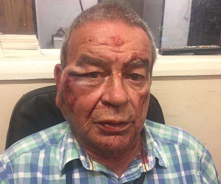 Taxi driver Rob King, 64, shortly after he was attacked in his cab while parked in Sheerness