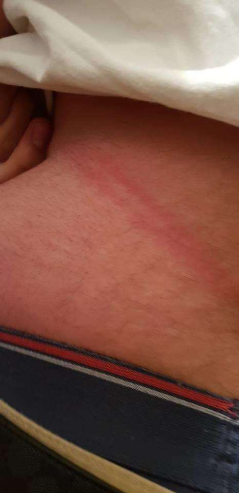 A teenage boy from Gravesend was left with bruises after being assaulted with a baton. (2444686)