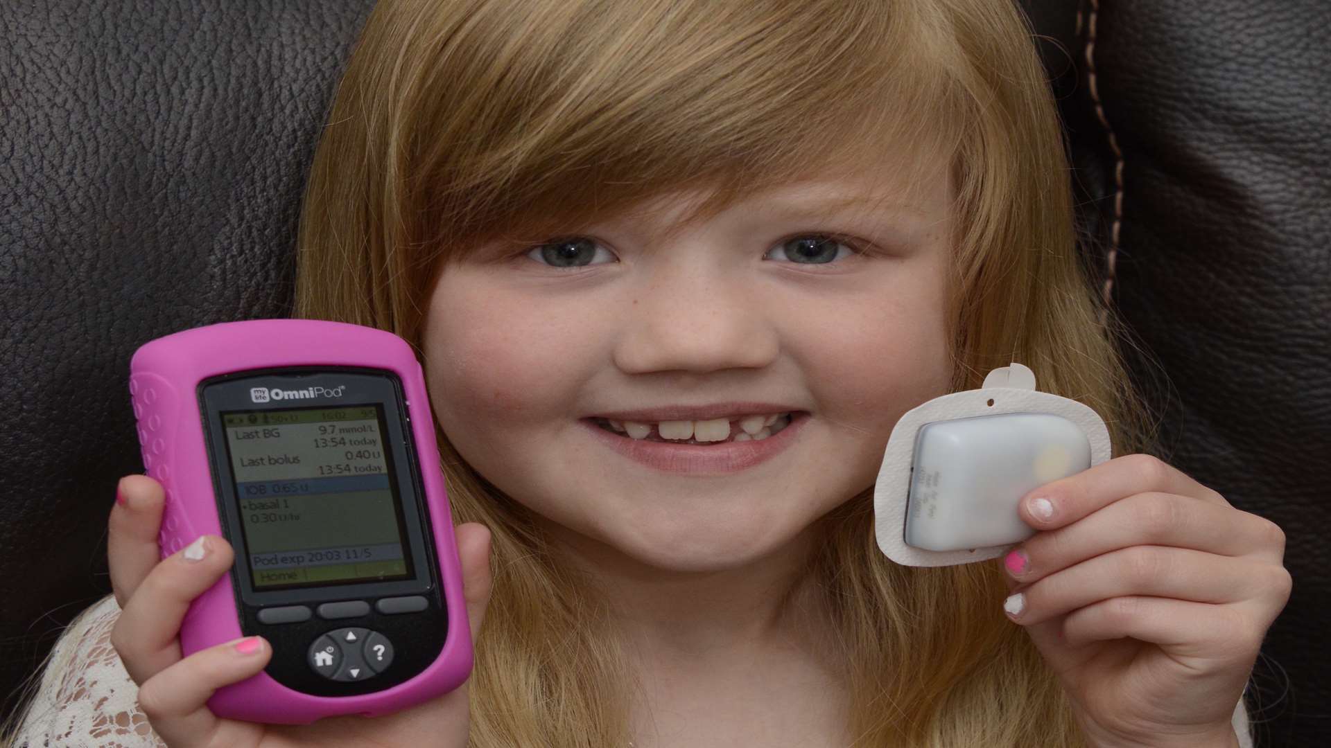 Isabella Lewis is one of the first to use an Omnipod to control her diabetes. Picture: Paul Amos