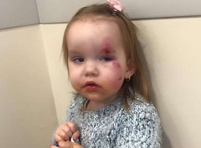 Leah, 22 months, was injured in a car crash
