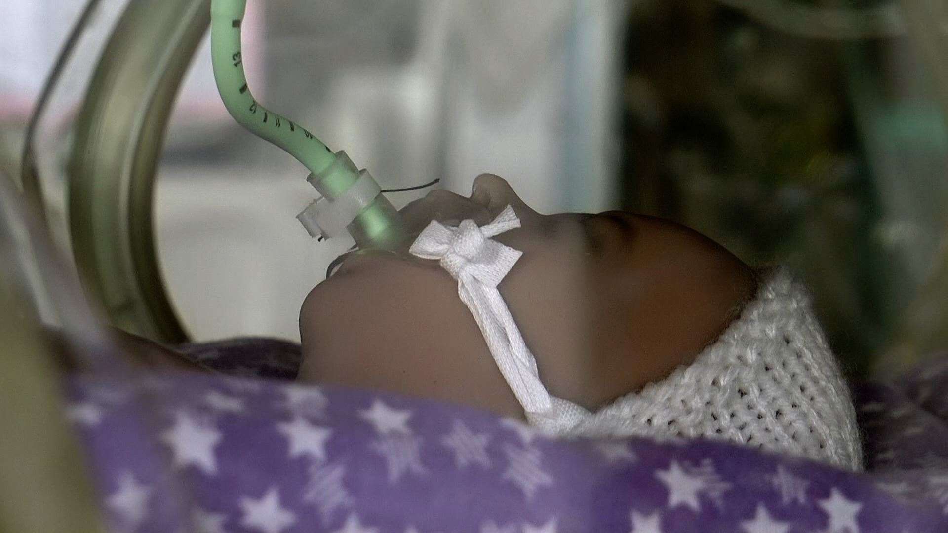 A premature baby at Medway Maritime Hospital