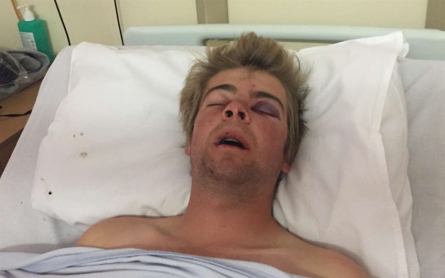 Josh in hospital after the attack