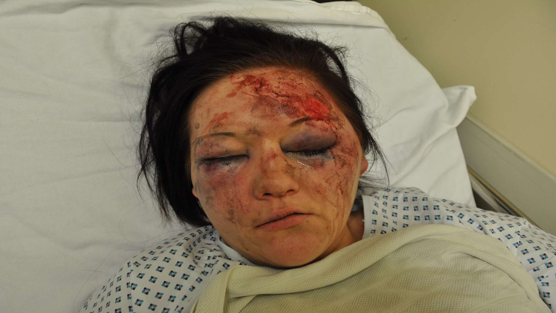 Litisha Henry was left with horrific injuries