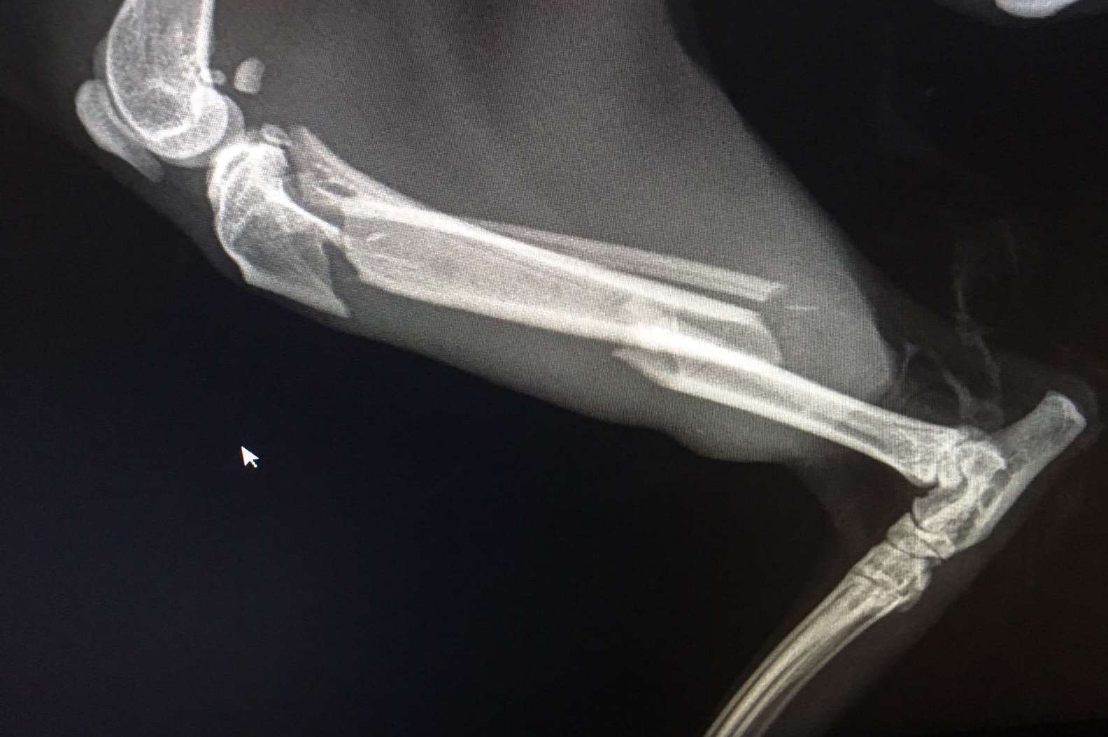 An X-ray of Nigel's leg