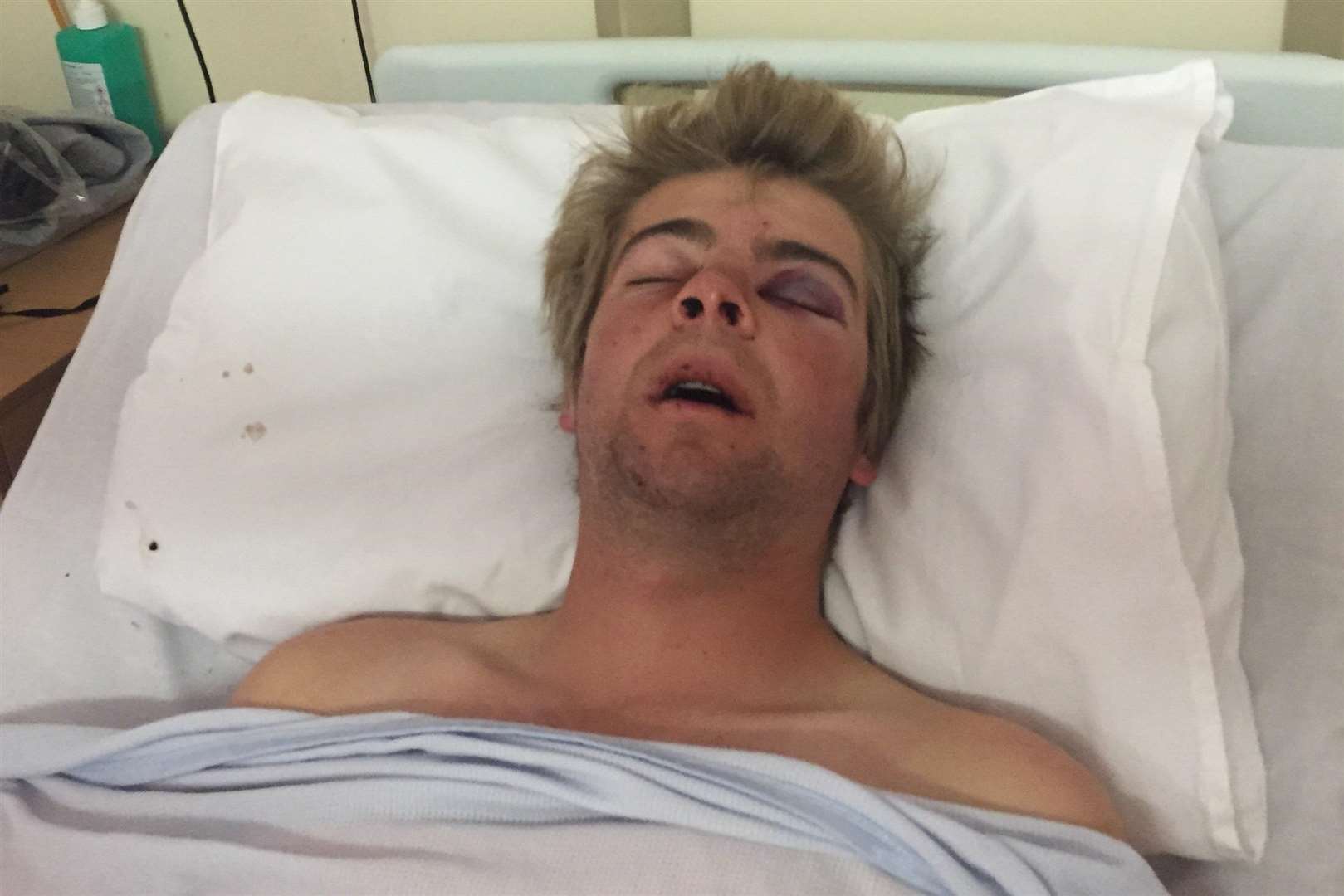 Josh in hospital after the attack