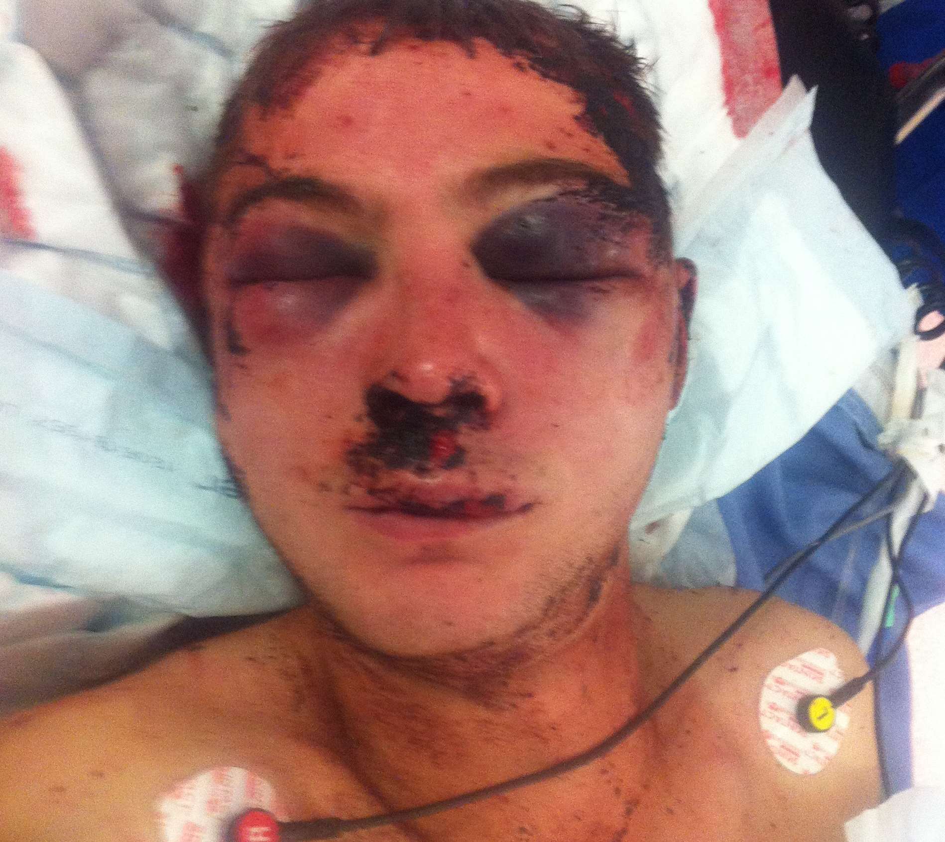 Victim Joe Bath's mother didn't recognise him after he was left for dead in a vicious attack