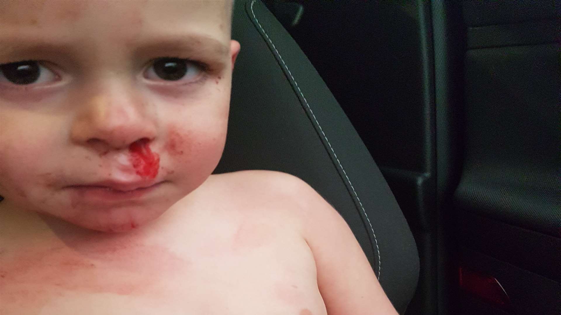 Tommy O'Brien,two, suffered a bloodied nose after the accident in the supermarket