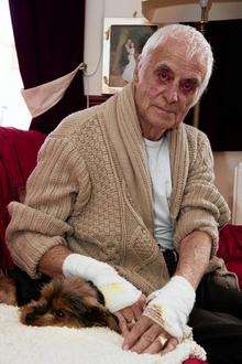 Tom Powell, of Sheppey, was walking his dog Sally when three Bull Mastiffs attacked.