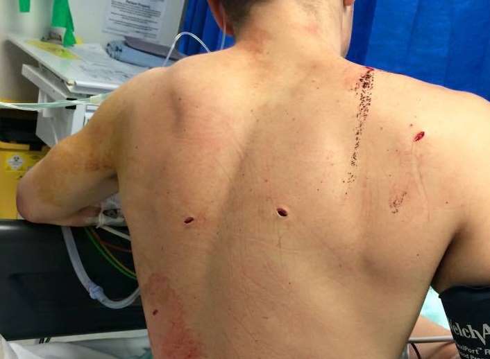 The stab wounds on David Reynolds' back