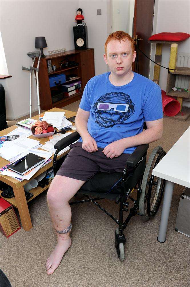 Electrician Ashley Willoughby had his leg amputated after a motorbike crash