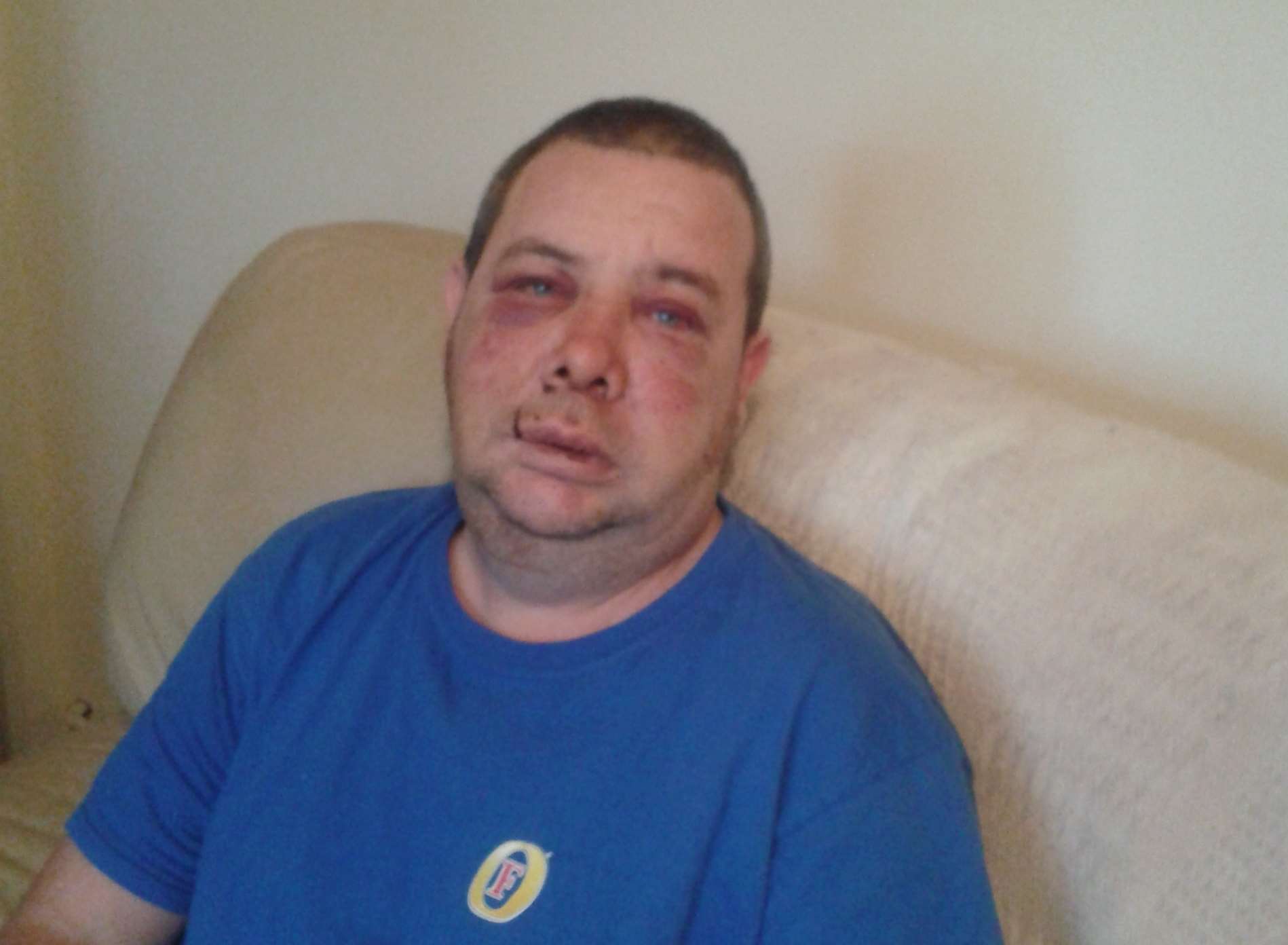 Colin Harvey recovering at his Ramsgate home after the brutal attack