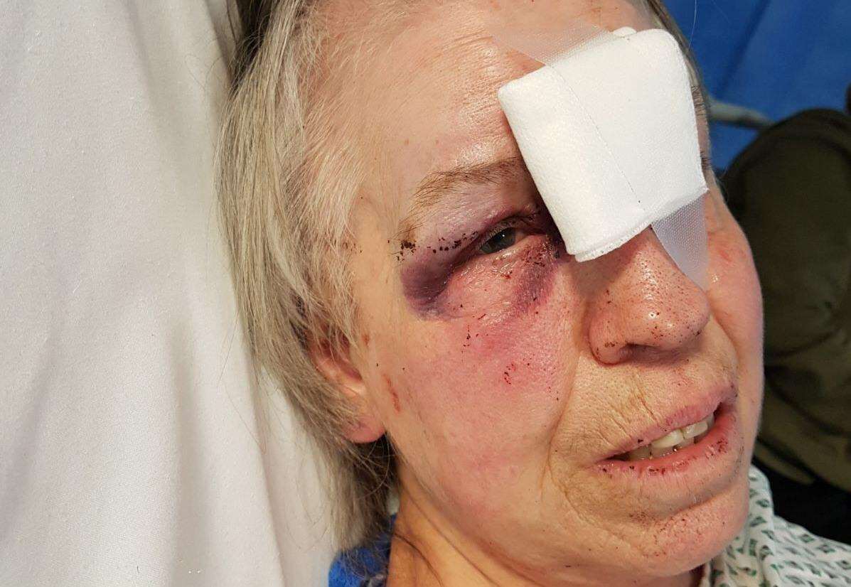 Lesley Wilson, 69, was punched and kicked when she had her handbag stolen