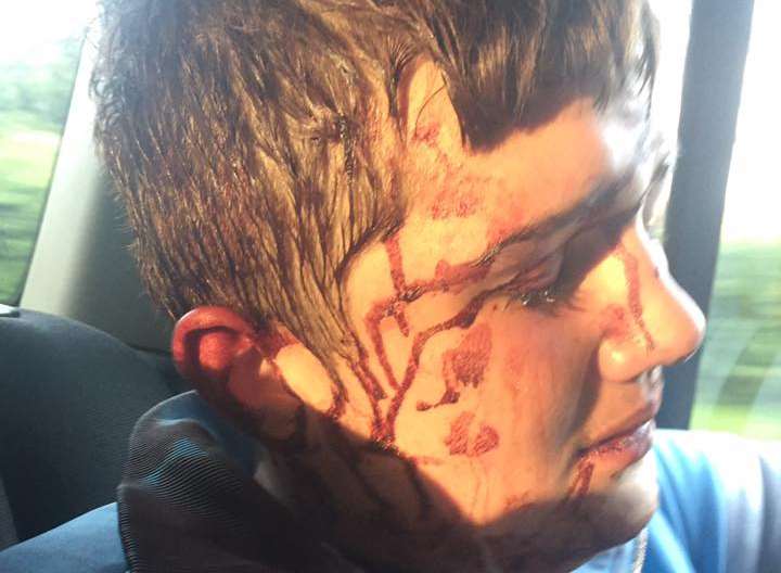 Harry Diamond was allegedly assaulted in Tonbridge. Picture: Nicki Rogers