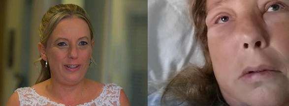 Michelle on her wedding day in June 2013, and in hospital in October 2014, her face swollen by illness