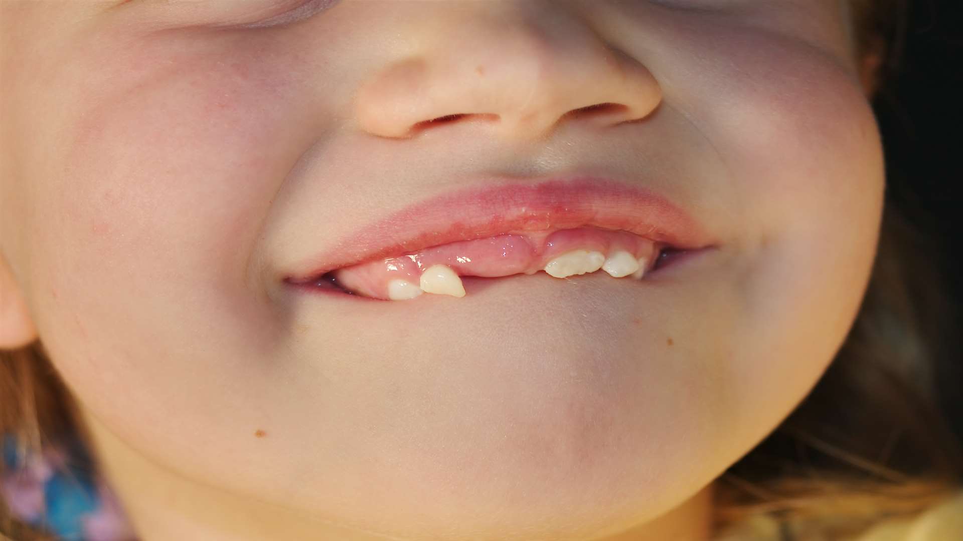 The figures show some children are not attending dental check-ups