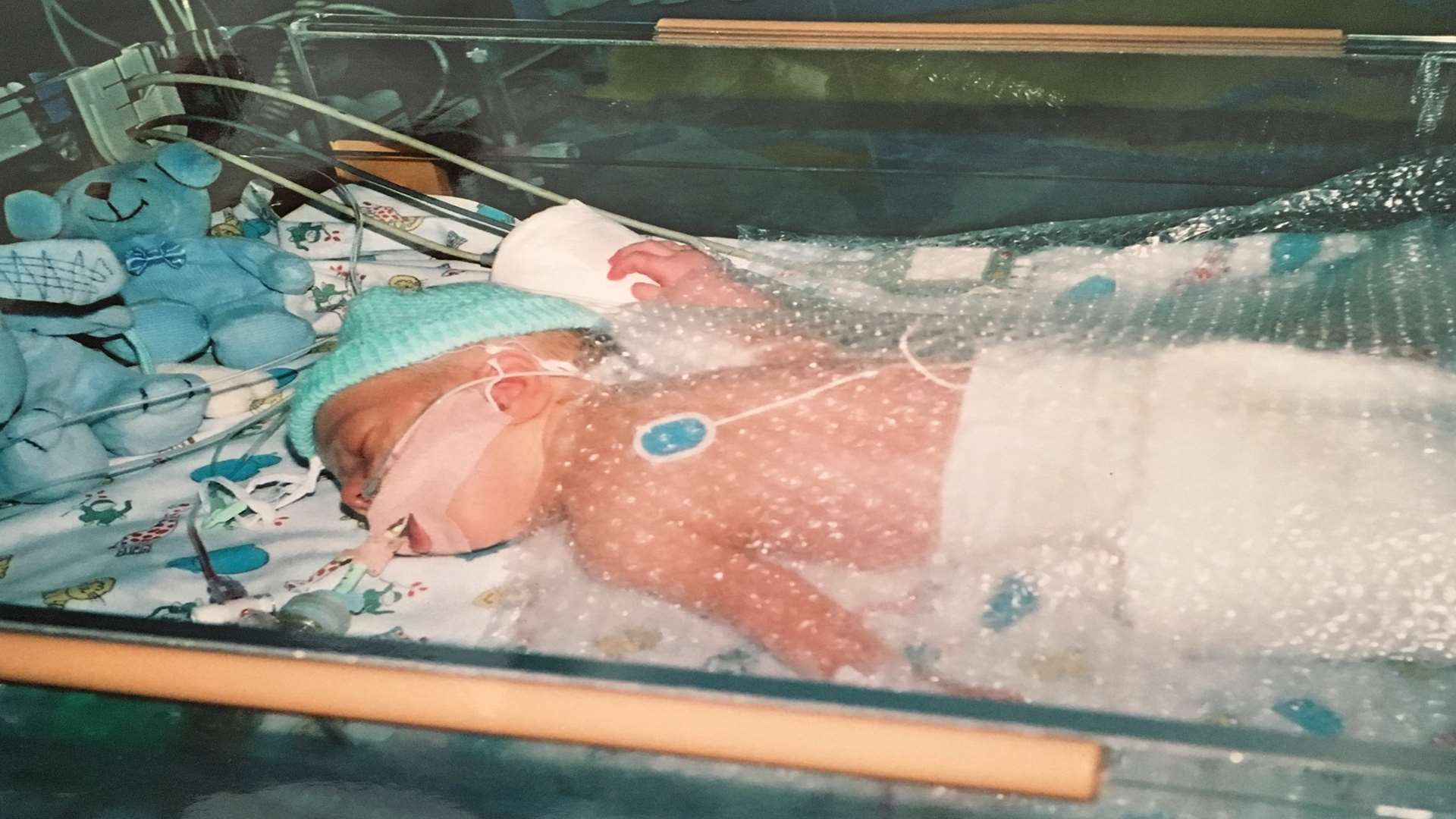 Ben Thomas when he was in hospital as a baby