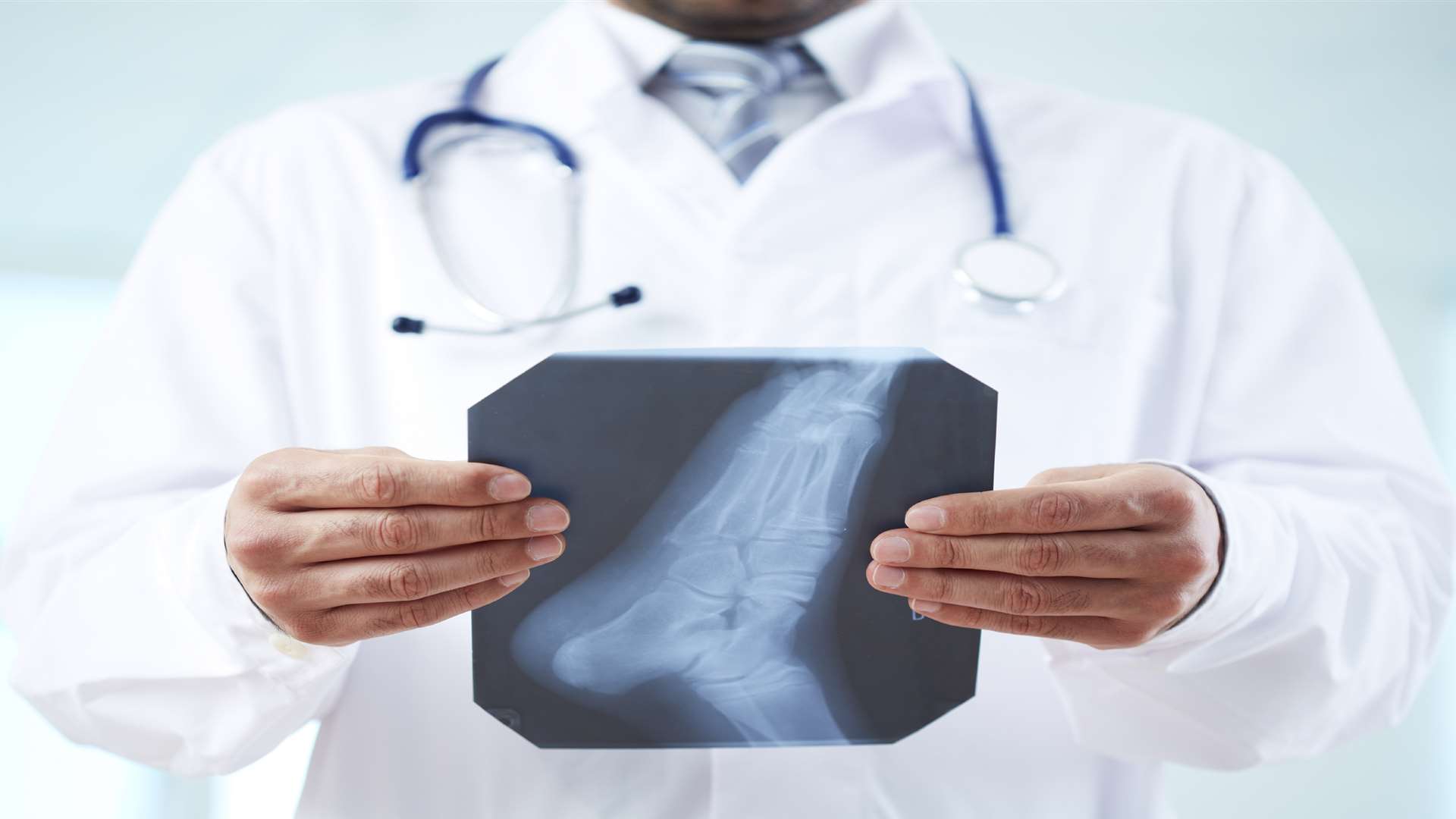 An X-ray (Stock picture)