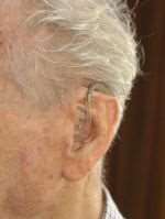 Hearing aid waiting times have been slashed