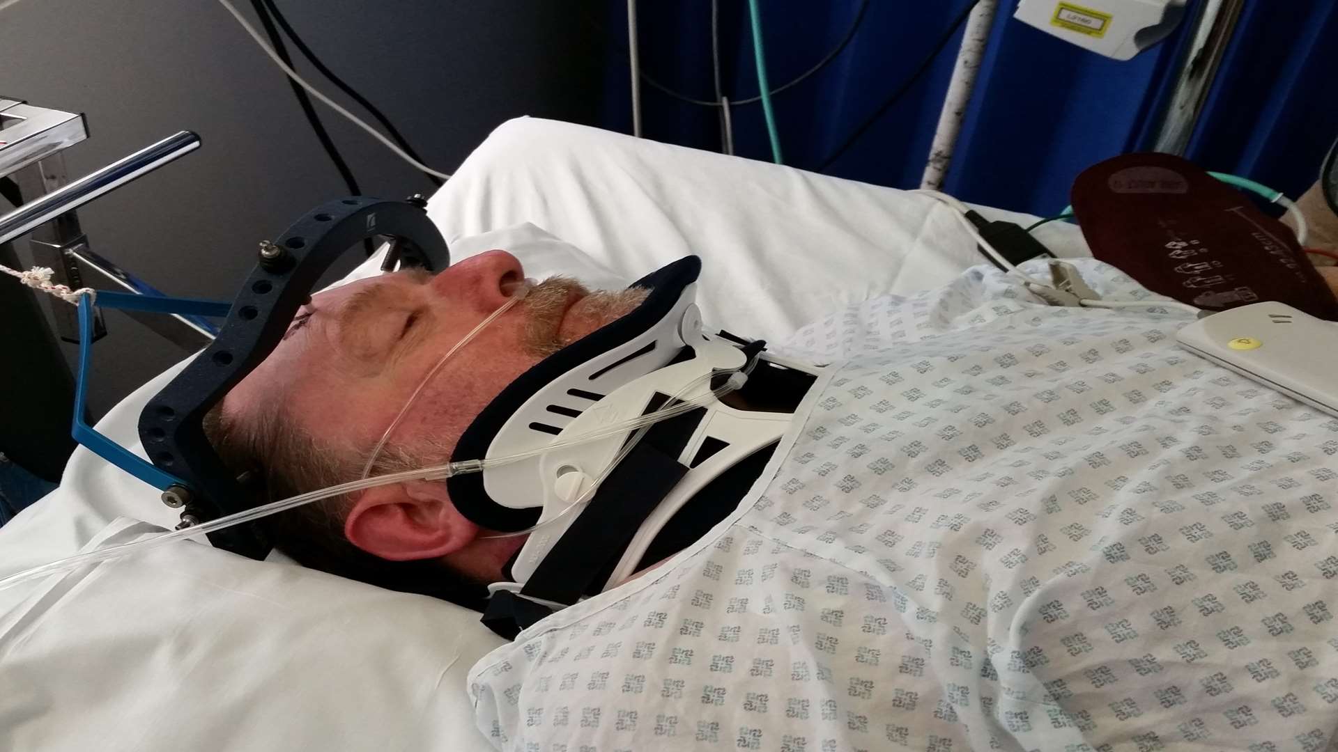 Signalman Doug Caddell recovering after the accident at East Farleigh level crossing