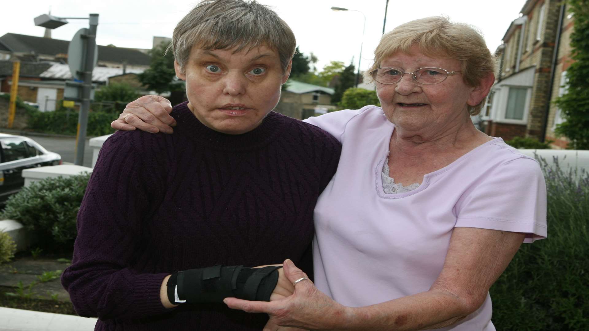 Julia Knight, pictured with mum Edna Woolfries, broke three fingers and suffered a suspected broken wrist after falling from the kerb in the town centre