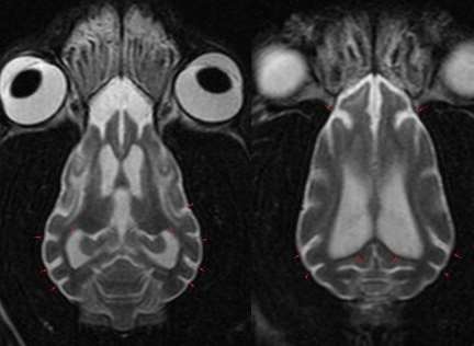 Scary got a free £1,750 MIR scan for his twisted neck