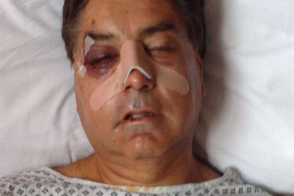 Jas Upaul in hospital after being attacked with a baseball bat at home