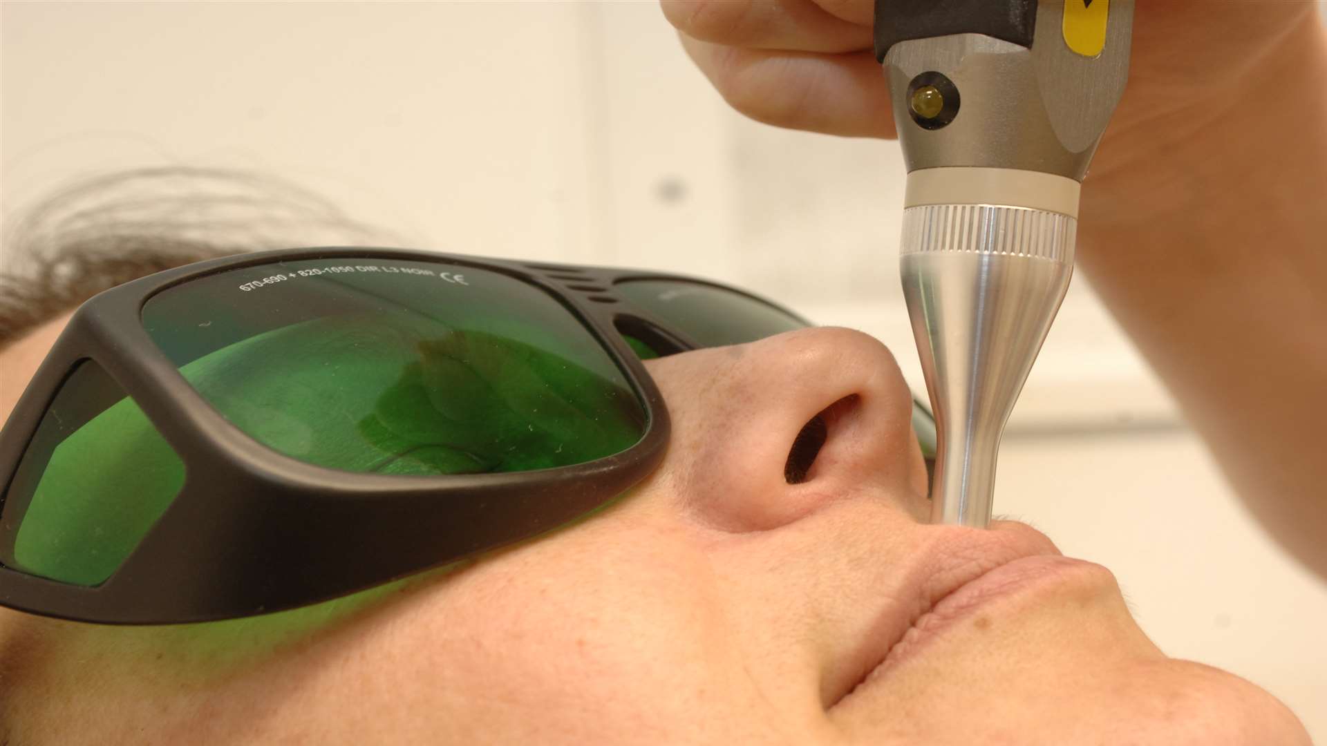A laser treatment at Canterbury Skin and Laser Clinic