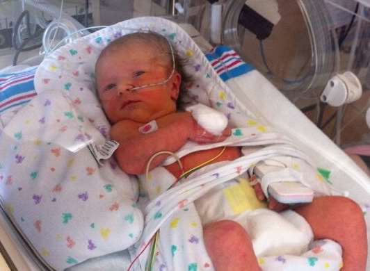 Little Amy stopped breathing for eight minutes and her parents were told she might be paralysed