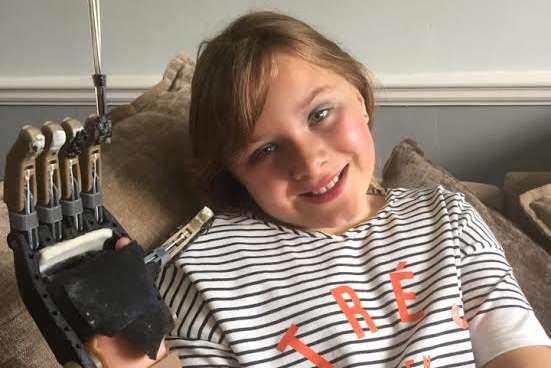 Isabella Rudd was fitted with a 3D printed hand