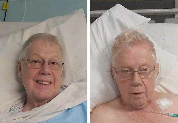 Malcolm Sapsed when he was first admitted to Medway Hospital and now. Picture: Lacey Hider
