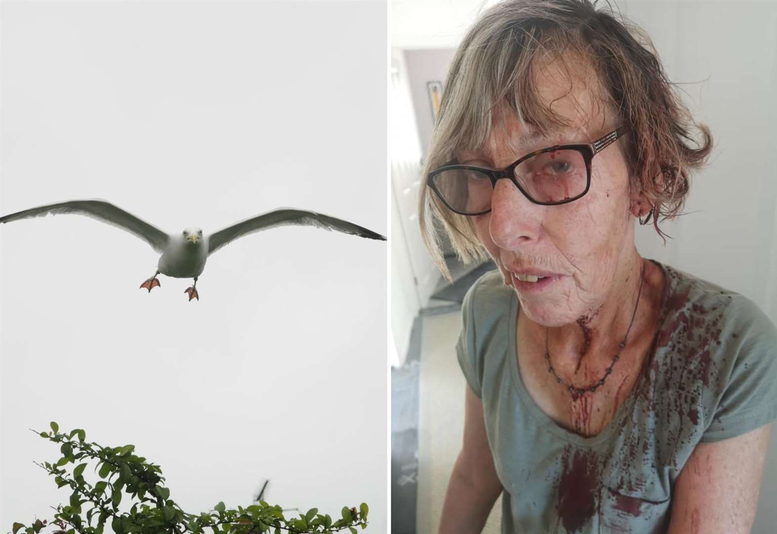 Vicious seagull attack leaves gran soaked in blood